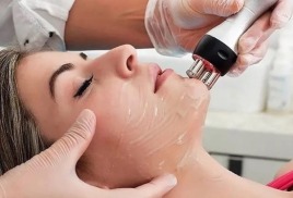 Ппроцедура RF-лифтинга лица